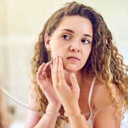 Акне на лице: причины появления угрей, лечение и уход за кожей