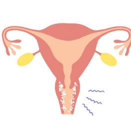 Бактериялық вагиноз дегеніміз не және ол өздігінен кетуі мүмкін бе